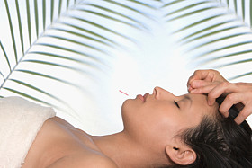 relaxing acupuncture